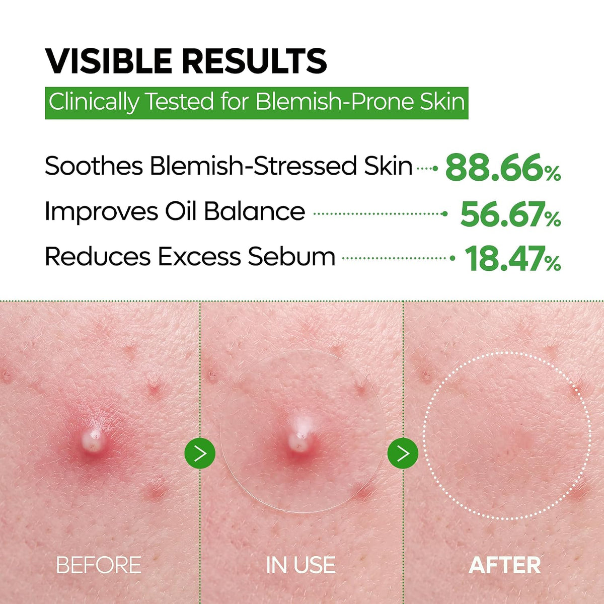PRE-MAKEUP SPOT PATCHES | Ultra-Thin Clear Blemish & Dark Spot Patches for a Smoother Makeup Finish