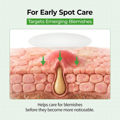 PRE-MAKEUP SPOT PATCHES | Ultra-Thin Clear Blemish & Dark Spot Patches for a Smoother Makeup Finish
