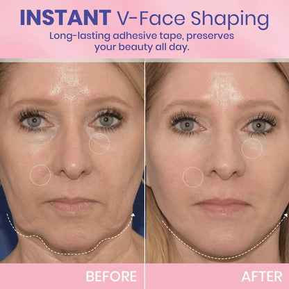 V-Face⭐ Lifting Invisible Adhesive Tape