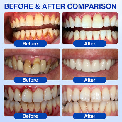 Advanced Enamel & Gum Care